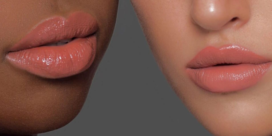 well-defined lip lines