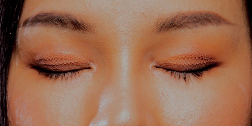 defined eyelid crease